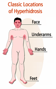 Parts of the body subject to excessive sweating